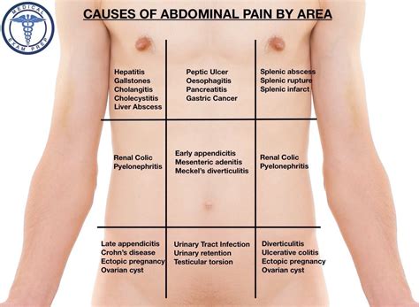The Differential Diagnosis Of Abdominal Pain By Area
