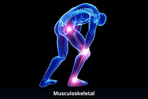 Musculoskeletal About Clinical Trials And Medical Devices Image