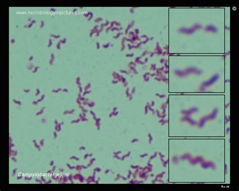 Campylobacter Jejuni Micrograph Appearance Of Cjejuni Under A