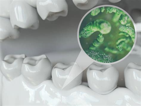 4 Signs Of Dental Caries Bacteria And How To Avoid Them Twilight