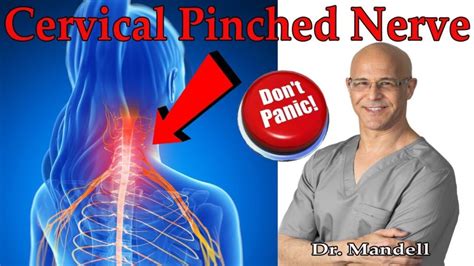 How To Overcome Cervical Pinched Nerve And Radiculopathy Dont Panic