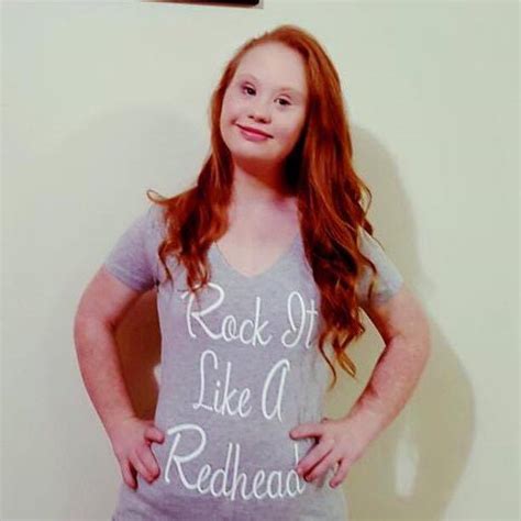 redhead model with down syndrome madeline stuart