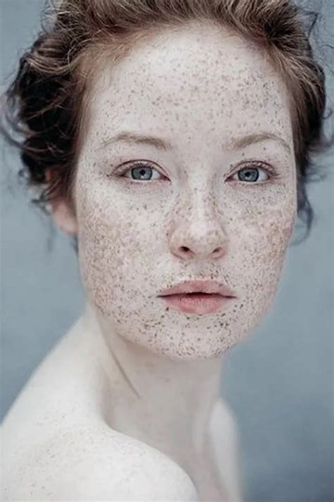 Sexy Pale And Freckled Telegraph