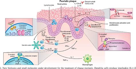 New Drugs And Treatment Targets In Psoriasis Semantic Scholar
