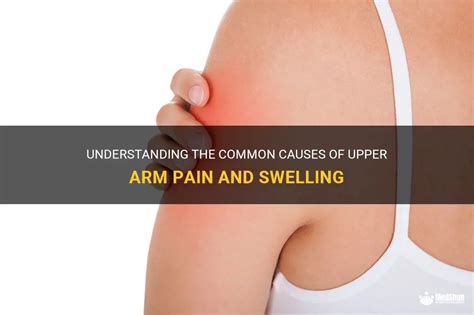 Understanding The Common Causes Of Upper Arm Pain And Swelling Medshun
