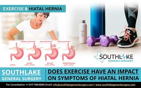 Hiatal Hernia And Exercise