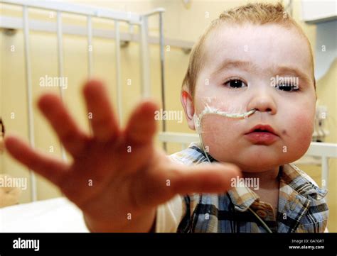 Jack Vellam 13 Months Who Has Become The Worlds First Baby To Survive