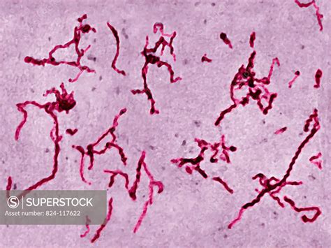 Leptospira Interrogans The Bacterium Responsible For Weil´s Disease