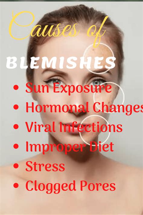 How To Get Rid Of Blemishes At Home Home Remedies Beauty And