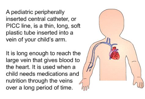 Pin On Picc Line Peripherally Inserted Central Catheter