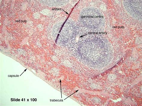 Pin On Histology Lymphatic System And Immunity