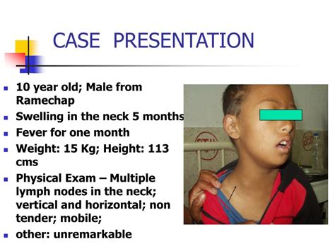 Ppt Approach To A Child With Cervical Lymphadenopathy Powerpoint