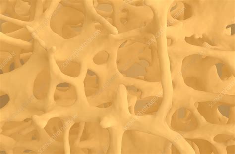 Osteoporotic Bone Tissue Illustration Stock Image F0389857