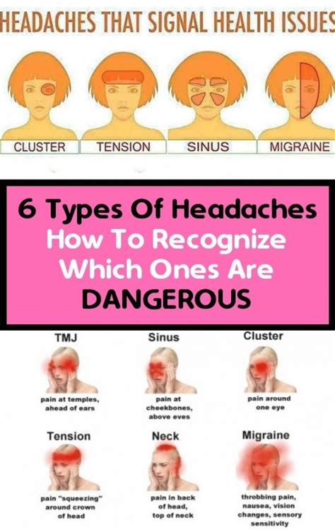 Tension Headache Tmj Information Aboutheadache