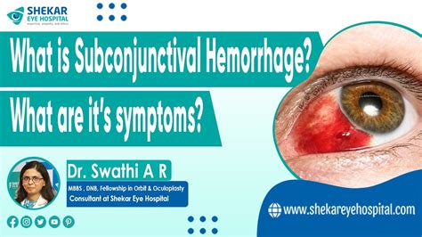 Subconjunctival Hemorrhage Blood In Eye Symptoms Signs Causes Of