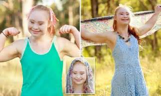 Madeline Stuart With Down Syndrome Lands Contract With Fitness Brand