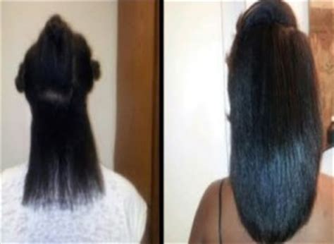 Please share in the comment box below… African American Hair Growth Biotin, Natural Remedies ...