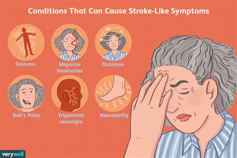 Mini Stroke Tia Stroke Causes Symptoms Signs Treatmen