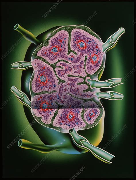 Lymph Node Stock Image P2900011 Science Photo Library