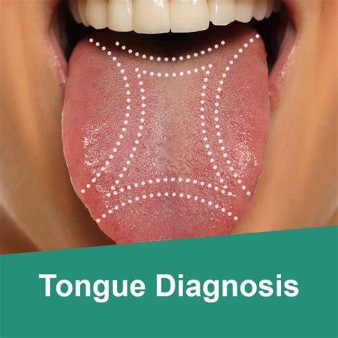 Tongue Diagnosis The Anp