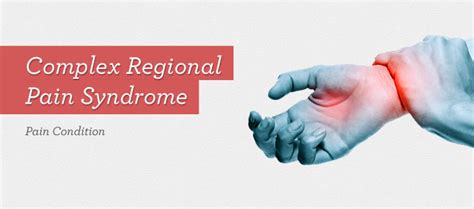 Complex Regional Pain Syndrome Crps Dr Michael A Castillo Md