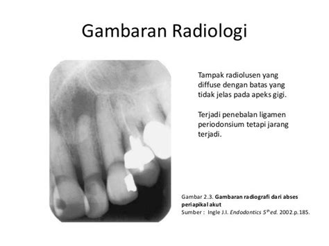 Penyakit infeksi dentomaksilofasial