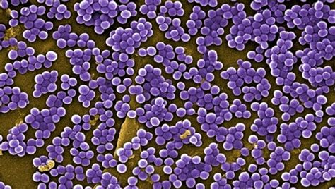 Toxic shock syndrome, vaccine trials ahead - Breaking Latest News