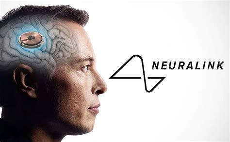 Khoa học/Công nghệ - Công ty cấy ghép não của Elon Musk - Neuralink đã