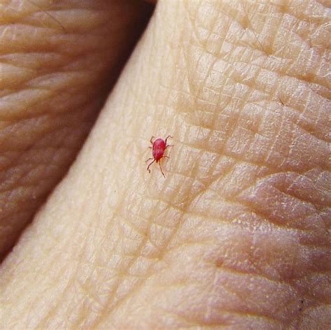 What Do Chigger Bites Look Like How To Get Rid Of Berry Bugs