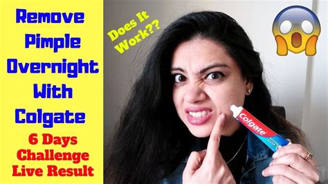 Colgate Toothpaste For Face Glowing Beauty Hacks To Get Rid Of Dark