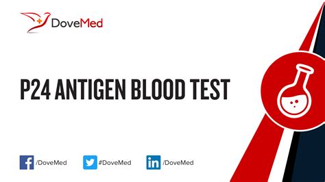 Podle odborného stanoviska společnosti pro. p24 Antigen Blood Test