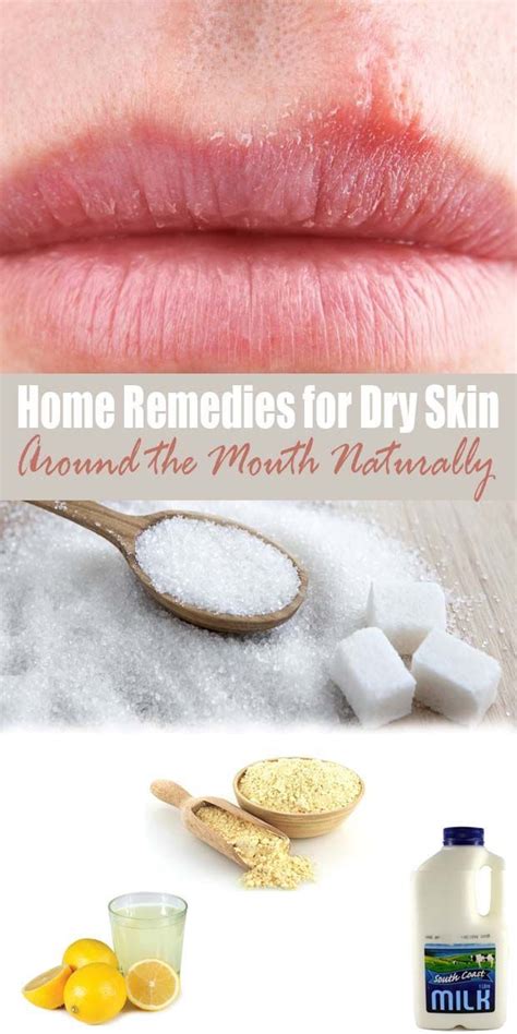 Home Remedies For Dry Skin Around The Mouth Naturally Dry Home