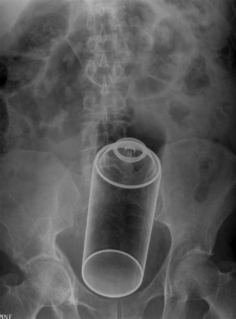A New Website Shows A Collection Of Some Of The Most Weird Xrays Out