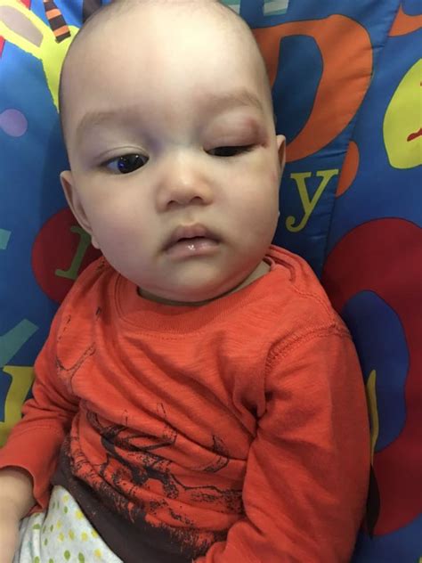 Jun 23, 2021 · dok. Lebam di mata dan badan, pengasuh kata bayi dibaling ...