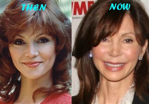Victoria Principal Plastic Surgery Before After Breast Implants