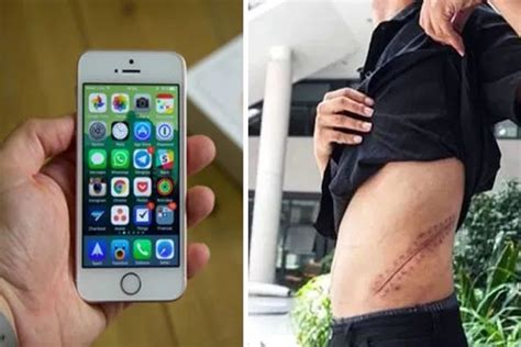 joven de 17 años vendió su riñon para comprarse un iphone y un ipad e tlaxcala mx