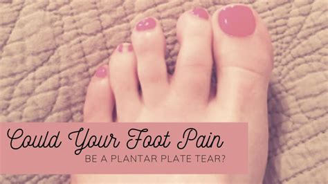 Plantar Plate Tear Causing Pain Under The Ball Of Your Foot Well