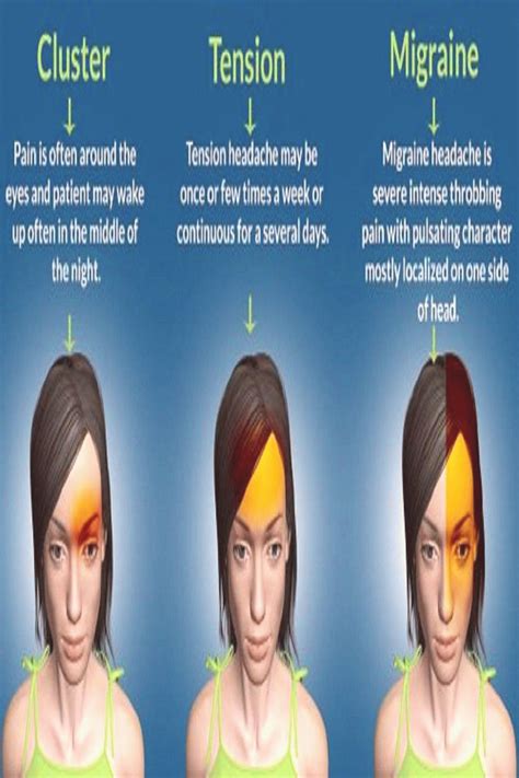Types Of Headaches Causes Types Headaches types of 