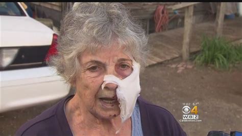 80 year old woman fights off rabid bobcat with sickle youtube