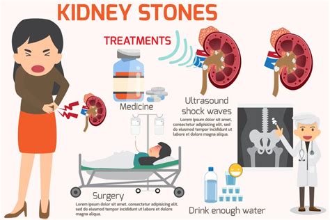 How To Dissolve Kidney Stones And Home Remedies Ck Birla Hospital