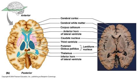 Its upper surface is concealed by the corpus callosum, and is covered by a fold of pia mater, named the tela chorioidea of the third ventricle; diencephalon | Exam 4 Review: Chapter 12: Diencephalon ...