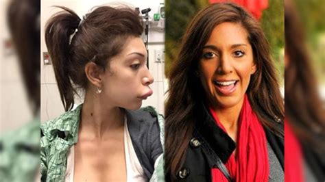 messed up here s how porn star farrah abraham looks after her botched lip job firstpost