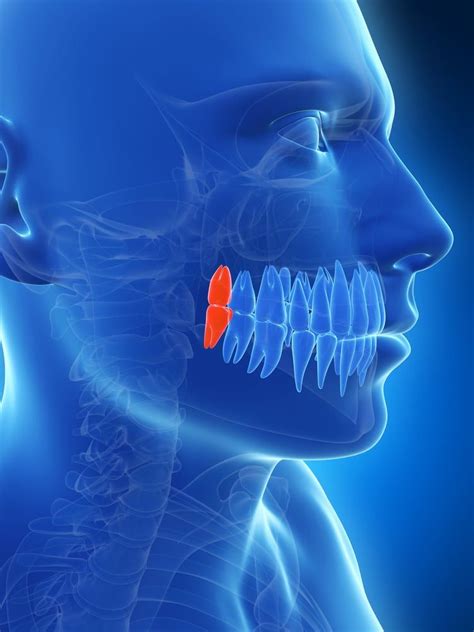Wisdom Teeth Removal Greenville Oral Surgery