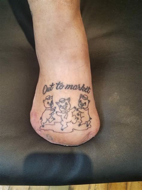 Friend Had To Get All Of Her Toes Removed She Commemorated The Surgery