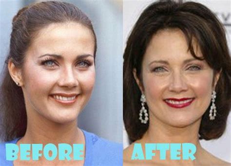 Lynda Carter Plastic Surgery Before And After Pictures Plastic