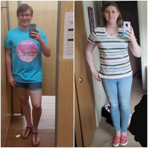 Left No Hrt And Right Months Of Hrt Plus Pounds Life Is Going Great R Transtimelines