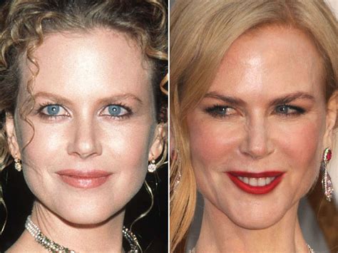 Nicole Kidman Before And After The Skincare Edit