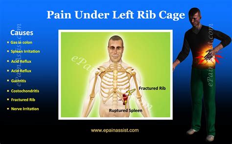 Are you concerned about rib cage pain? Pain In Lower Left Rib Cage Male - ovulation symptoms