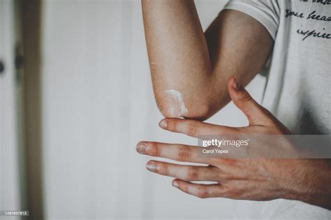 Dry Skin Elbow High Res Stock Photo Getty Images