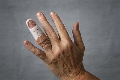 Recovering From Finger Surgery Healthfully